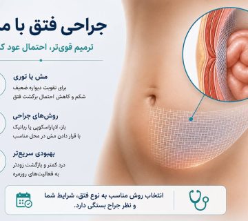 جراحی فتق با مش و ترمیم دیواره شکم