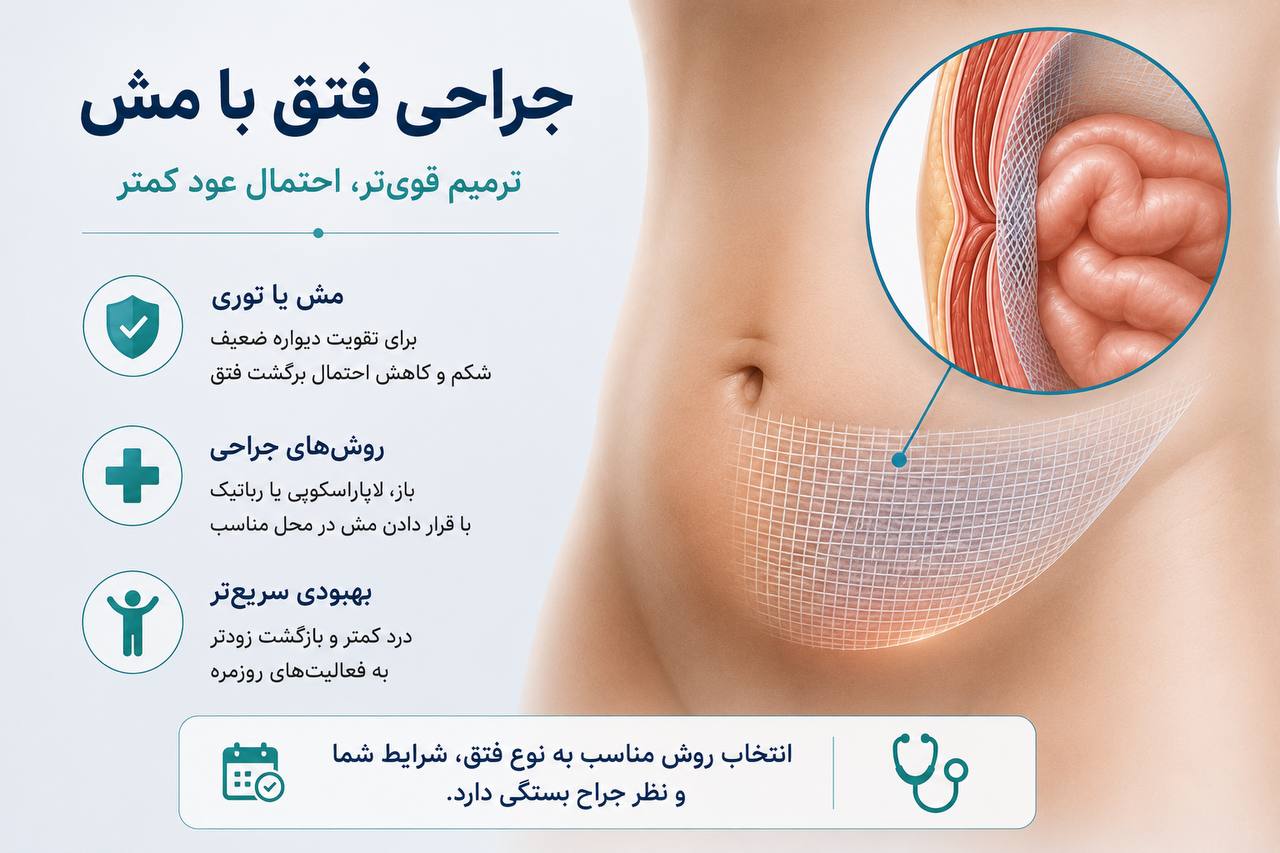جراحی فتق با مش و ترمیم دیواره شکم