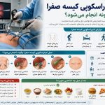 عمل لاپاراسکوپی کیسه صفرا