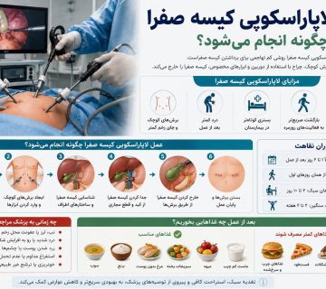 عمل لاپاراسکوپی کیسه صفرا