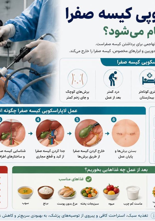 عمل لاپاراسکوپی کیسه صفرا