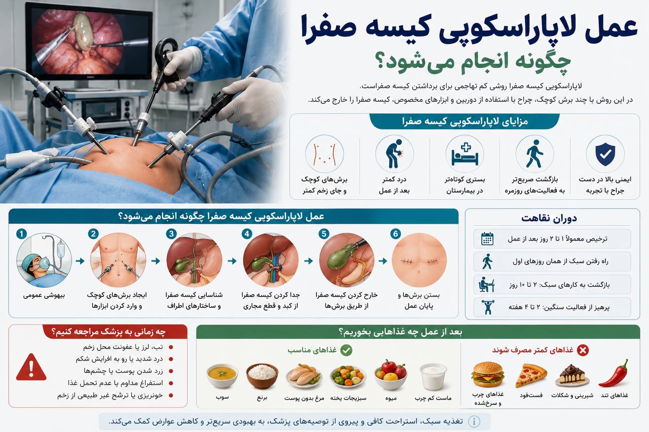 عمل لاپاراسکوپی کیسه صفرا