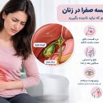 علائم کیسه صفرا در زنان