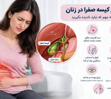 علائم کیسه صفرا در زنان