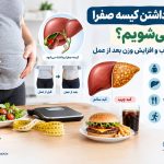 آیا بعد از عمل کیسه صفرا چاق می‌شویم؟