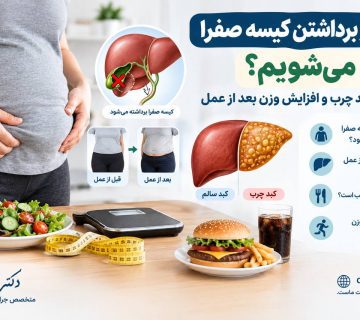 آیا بعد از عمل کیسه صفرا چاق می‌شویم؟
