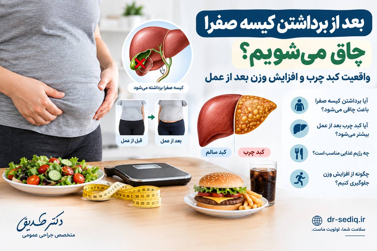 آیا بعد از عمل کیسه صفرا چاق میشویم؟